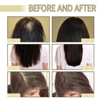 Thrive Locks™ - Hair Growth Oil 