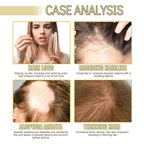 Thrive Locks™ - Hair Growth Oil 