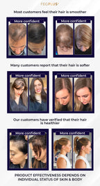 FEG PLUS | Most Viral Hair Growth Spray