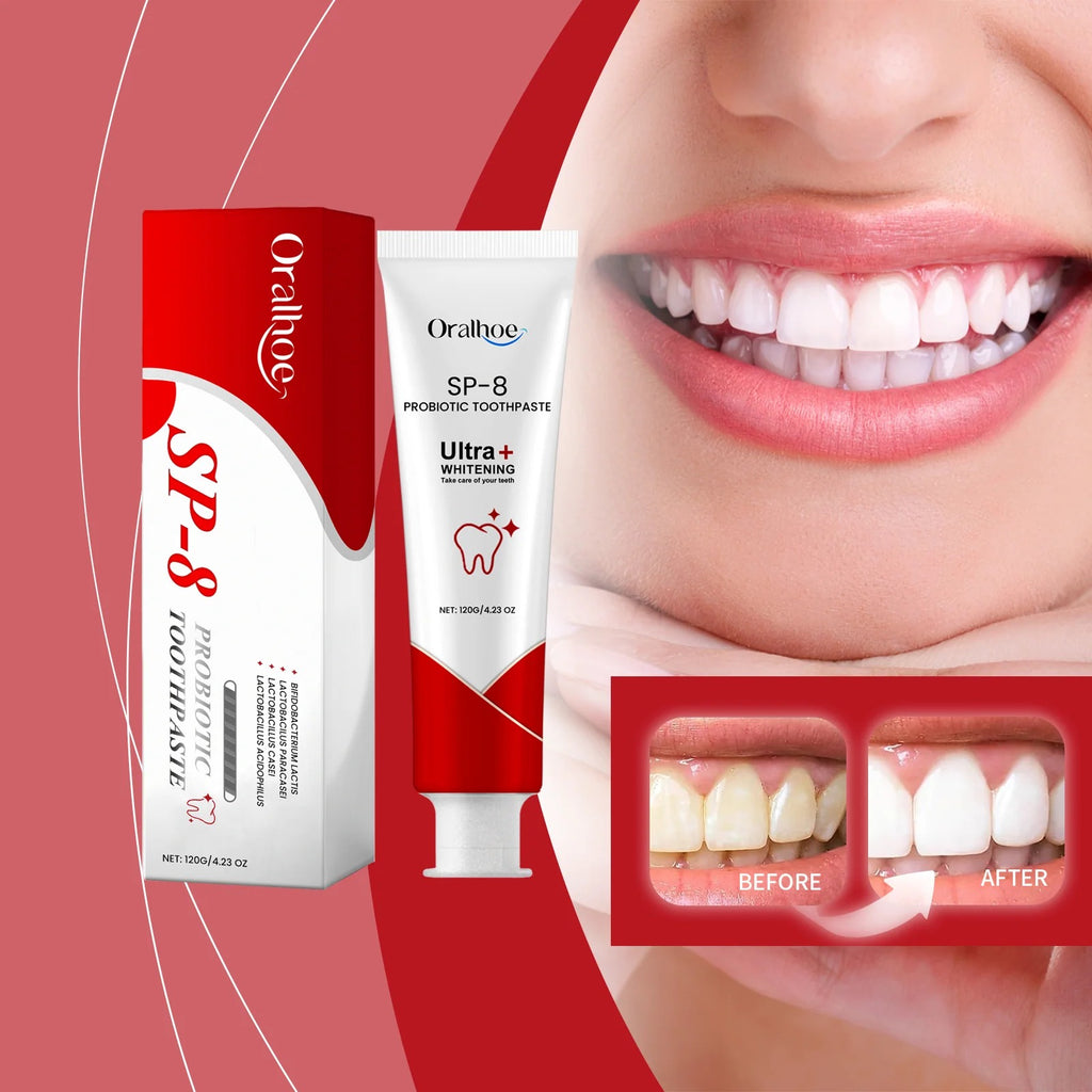 SP-8 Probiotic Toothpaste for Whitening & Deep Cleaning (120g)