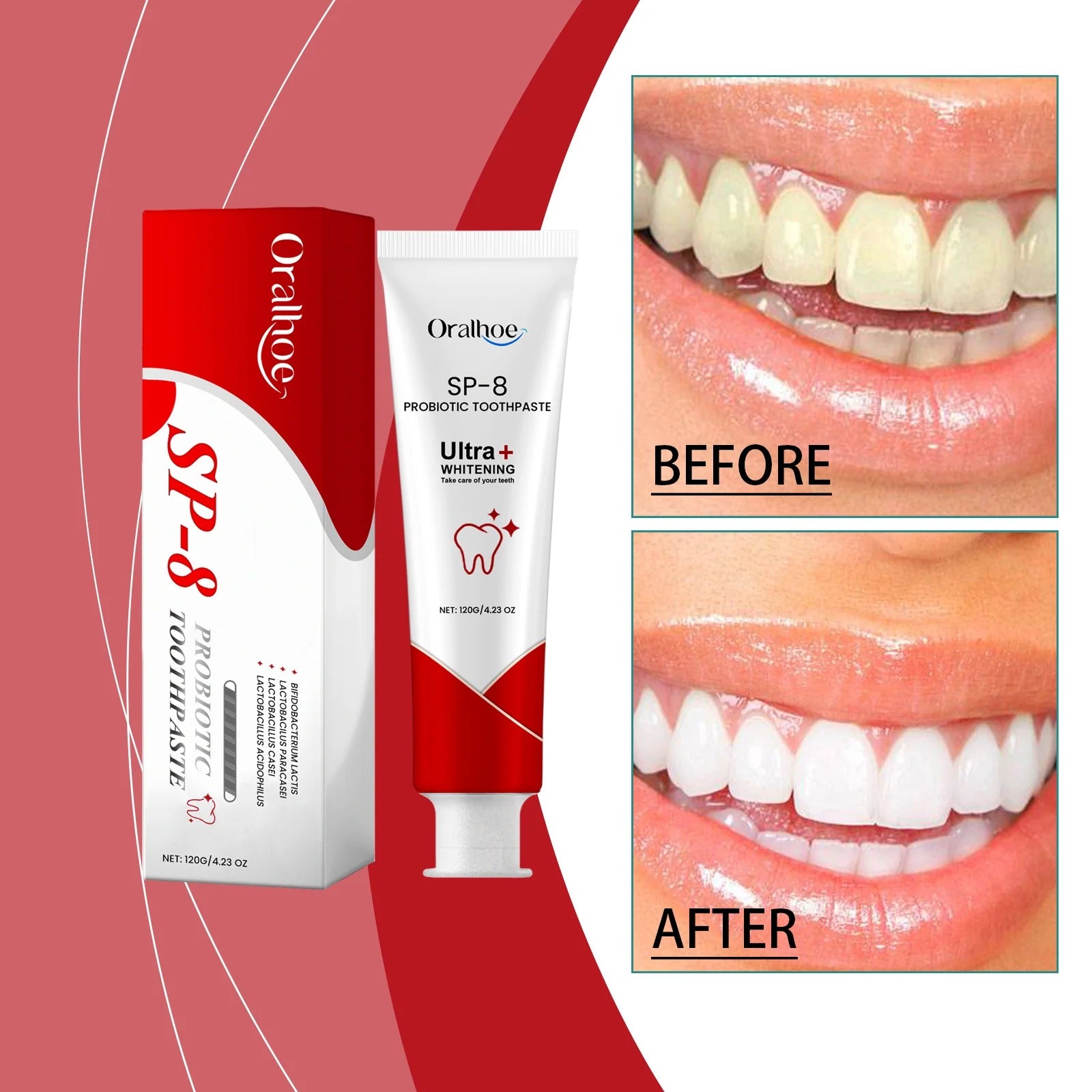 SP-8 Probiotic Toothpaste for Whitening & Deep Cleaning (120g)